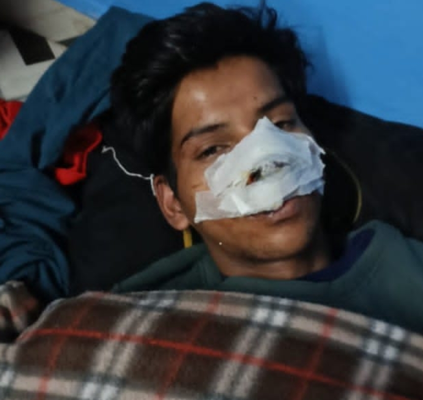 हल्द्वानी: दुकान के सामने स्कूटी खड़ी करने को लेकर हुआ विवाद,,,,,, युवक पर चाकू से हमला।