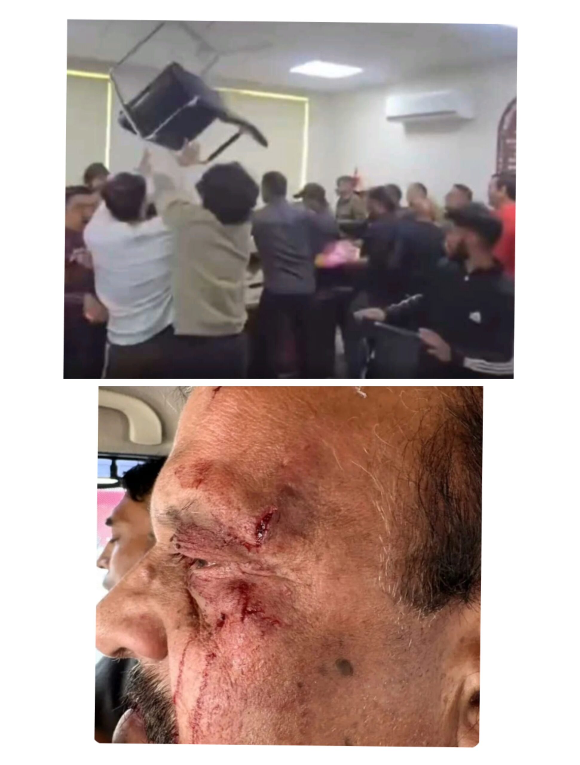 देहरादून:  निदेशक प्रारंभिक शिक्षा अजय कुमार पर जानलेवा हमला, BJP विधायक पर भी आरोप।